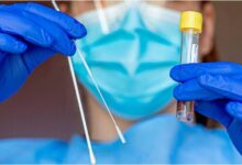 PCR test: Αισχροκέρδεια ή ζήτημα ποιότητας υπηρεσιών;