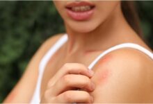Ενημερωτικές δράσεις για την «Προφύλαξη από τα κουνούπια» στα Τρίκαλα