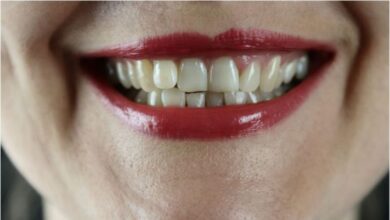 Γιατί κιτρινίζουν τα δόντια – tips για αστραφτερό χαμόγελο